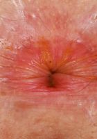 Apricot Pitts from ATK Natural & Hairy