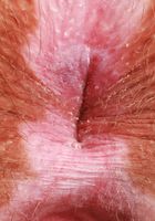 Bratty Wolfie Toe & Ass Spreading, Bratty Wolfie (bra041) ATK Natural & Hairy: Bratty Wolfie (Bratty Wolfie Toe & Ass Spreading)