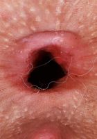 Evie gives a great look inside one of her gorgeous holes, Evie Christian (evi012) ATK Petites: Evie Christian (Evie gives a great look inside one of her gorgeous holes)