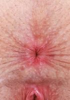 Fiona Peaches Lingerie Hairy Pussy and Ass Spreading, Fiona Peaches (fio012) ATK Natural & Hairy: Fiona Peaches (Fiona Peaches Lingerie Hairy Pussy and Ass Spreading)