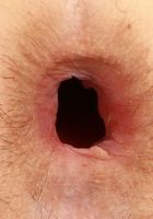 Jackie Hoff Huge Hole, Jackie Hoff (jac041) ATK Galleria: Jackie Hoff (Jackie Hoff Huge Hole)