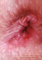 Kallie has a bush you've just got to see., Kallie Taylor (kal019) ATK Petites: Kallie Taylor (Kallie has a bush you've just got to see.)