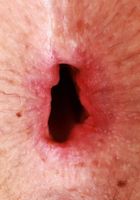 Leda Lotharia Hot Gaping Ass, Leda Lotharia (led002) ATK Galleria: Leda Lotharia (Leda Lotharia Hot Gaping Ass)