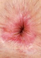 Minxx Marley Upskirt Spreads, Minxx Marley (min020) ATK Galleria: Minxx Marley (Minxx Marley Upskirt Spreads)