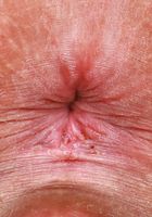 Remi Ferdinand Lingerie Hairy Pussy Spreads, Remi Ferdinand (rem005) ATK Natural & Hairy: Remi Ferdinand (Remi Ferdinand Lingerie Hairy Pussy Spreads)