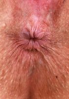 Rory Knox Gaping Holes, Rory Knox (ror001) ATK Petites: Rory Knox (Rory Knox Gaping Holes)